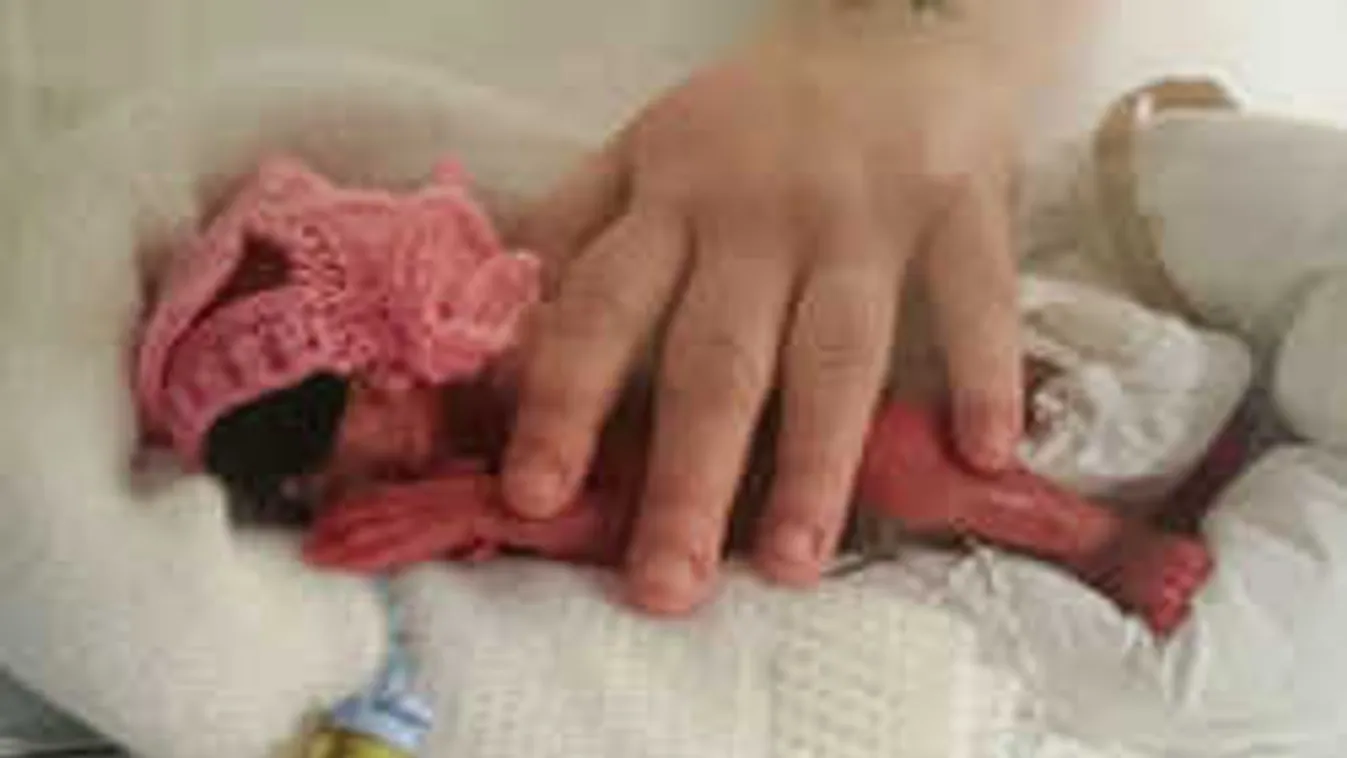 Két napon múlt a csodababa élete