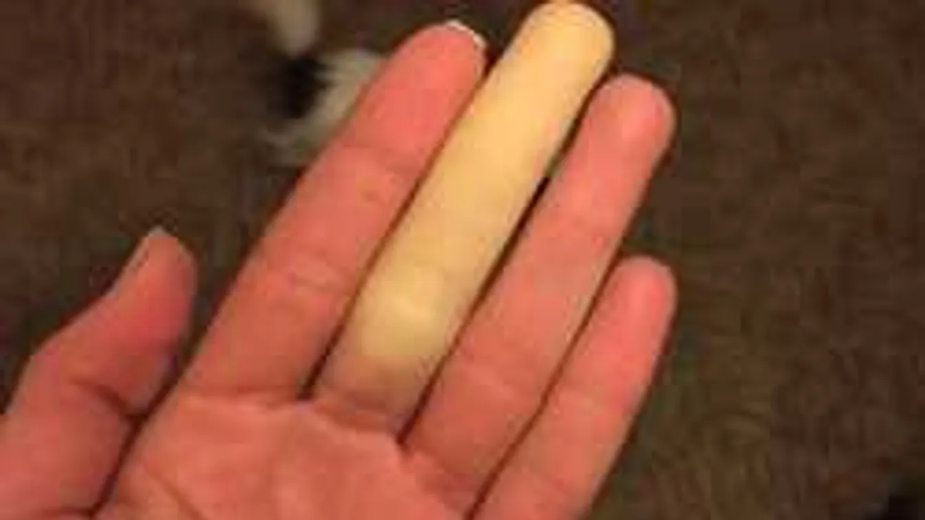 Az orvosok sem tudnak segíteni Kulcsár Edinán!