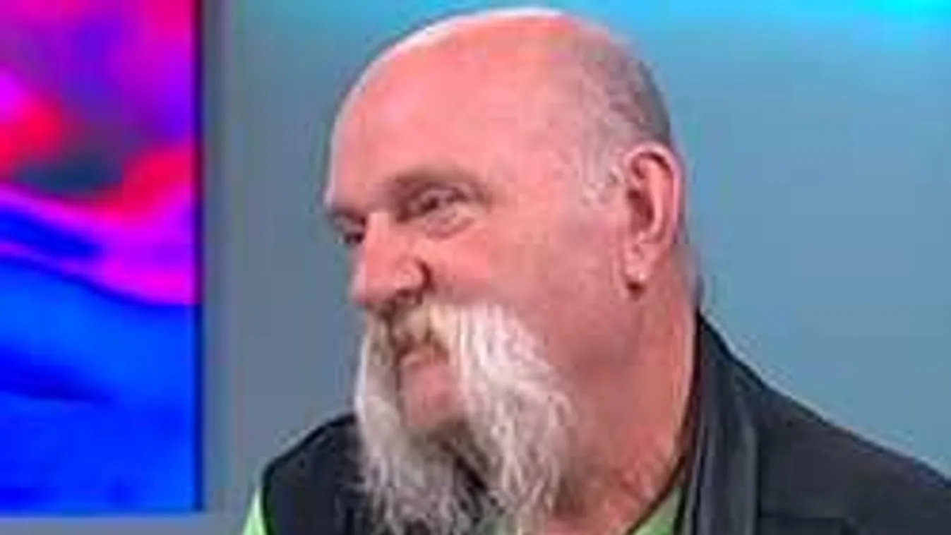 Súlyos műtét miatt kellett megválnia a védjegyétől a magyar zenésznek