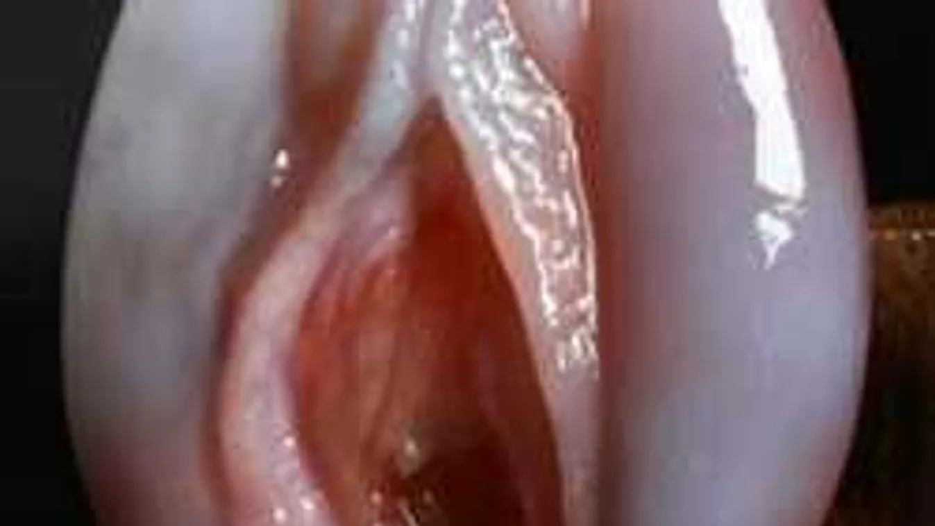 15 dolog, ami pont úgy néz ki, mint egy vagina - pedig nem az!