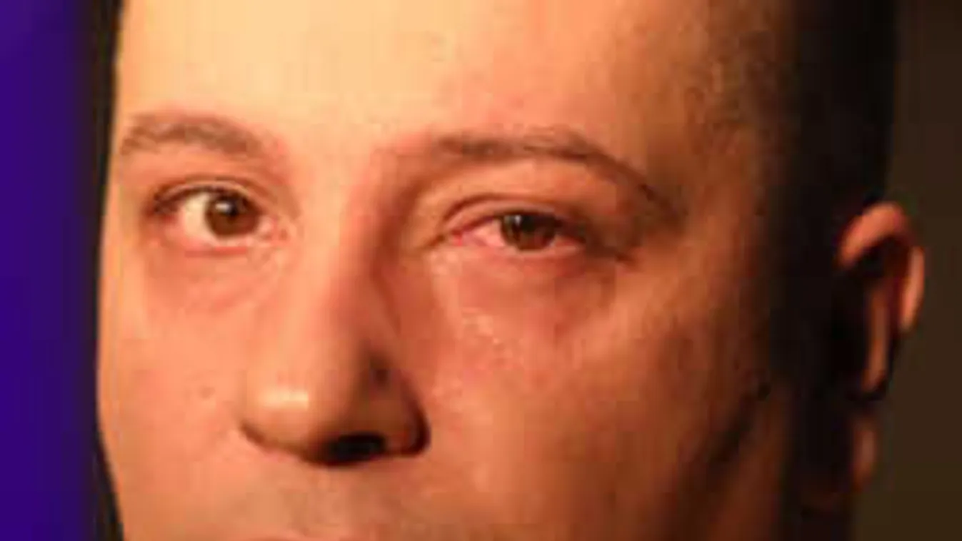 Súlyos betegséggel küzd, de mégis dolgozik a népszerű magyar sztár