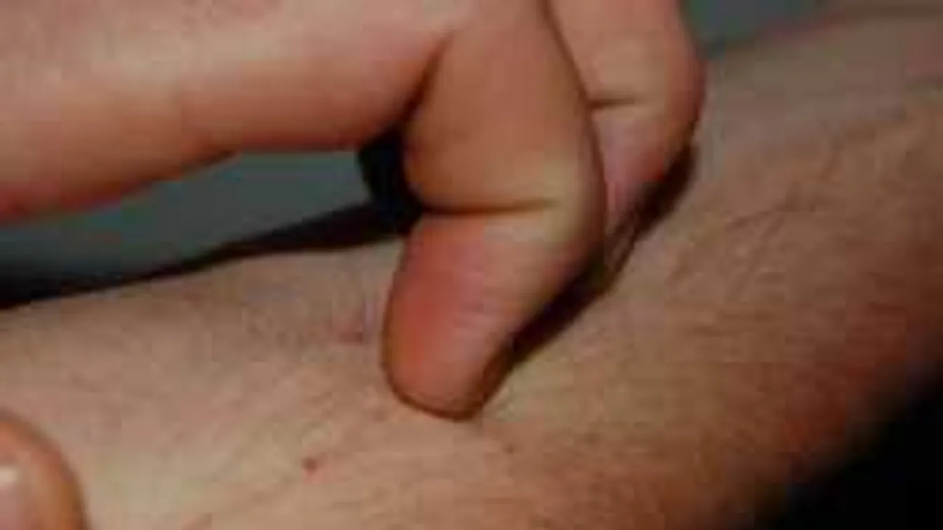 Vigyázz, a kalcium nem hatásos allergiára!