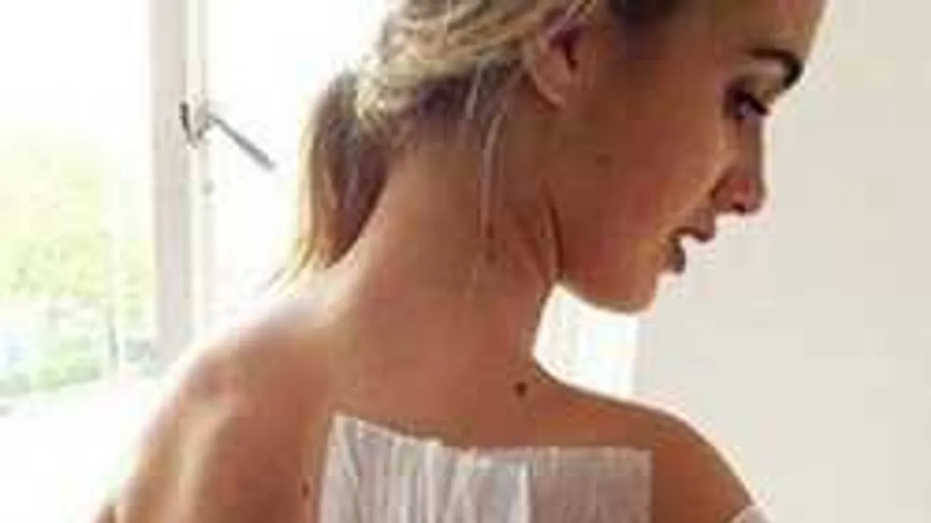 Egy modell is megsérült a savas támadásban