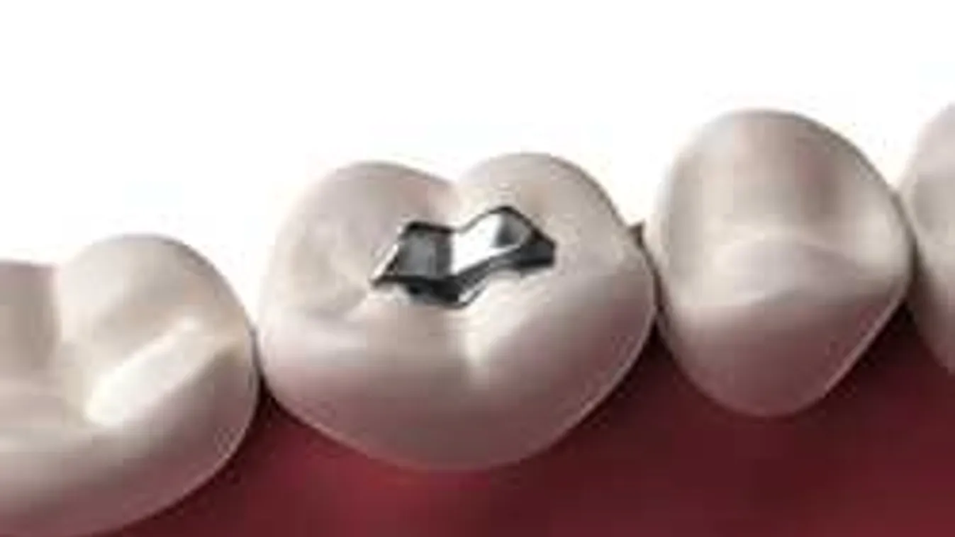 Kétmillió magyar van veszélyben: a lassú méreg nagyon megbetegít