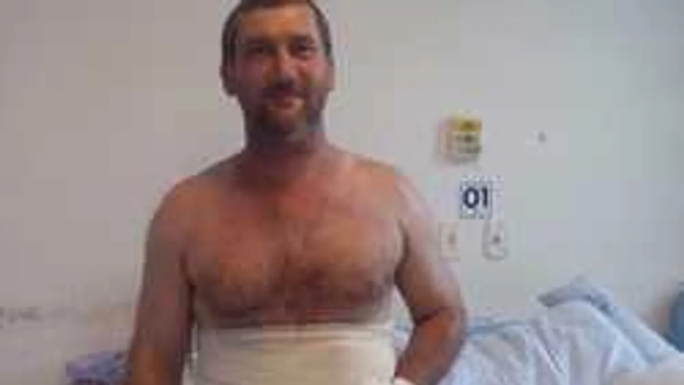 Elképesztő bravúrral mentették meg a gépkezelő széttrancsírozott kezét