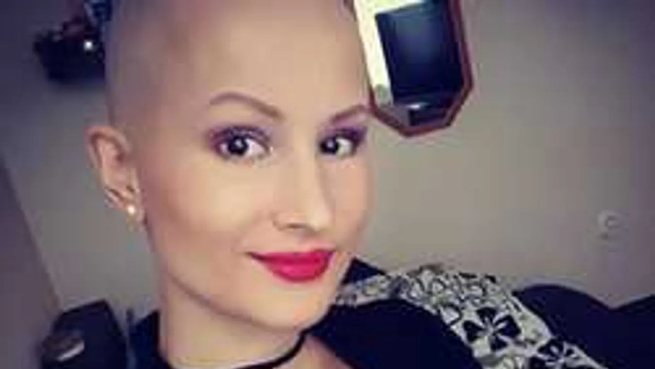 Végre egy kis boldogság: férjhez ment a leukémiás magyar modell!