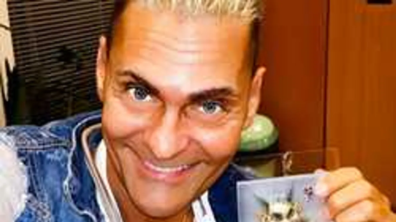 Mi történhetett: teljesen eltorzult a magyar mulatós sztár arca