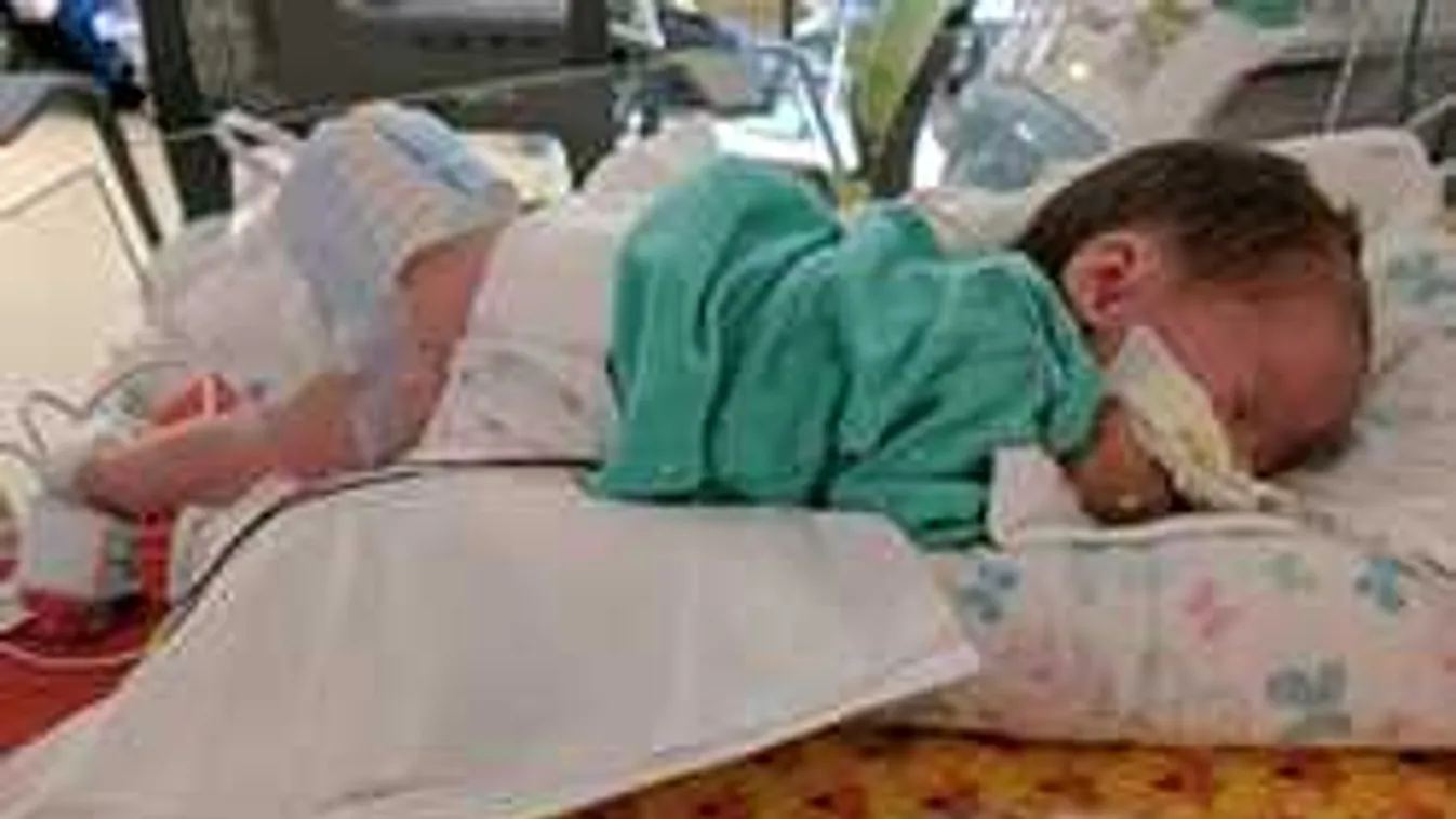 Az orvosok is megdöbbentek, rejtélyes betegséggel született a baba