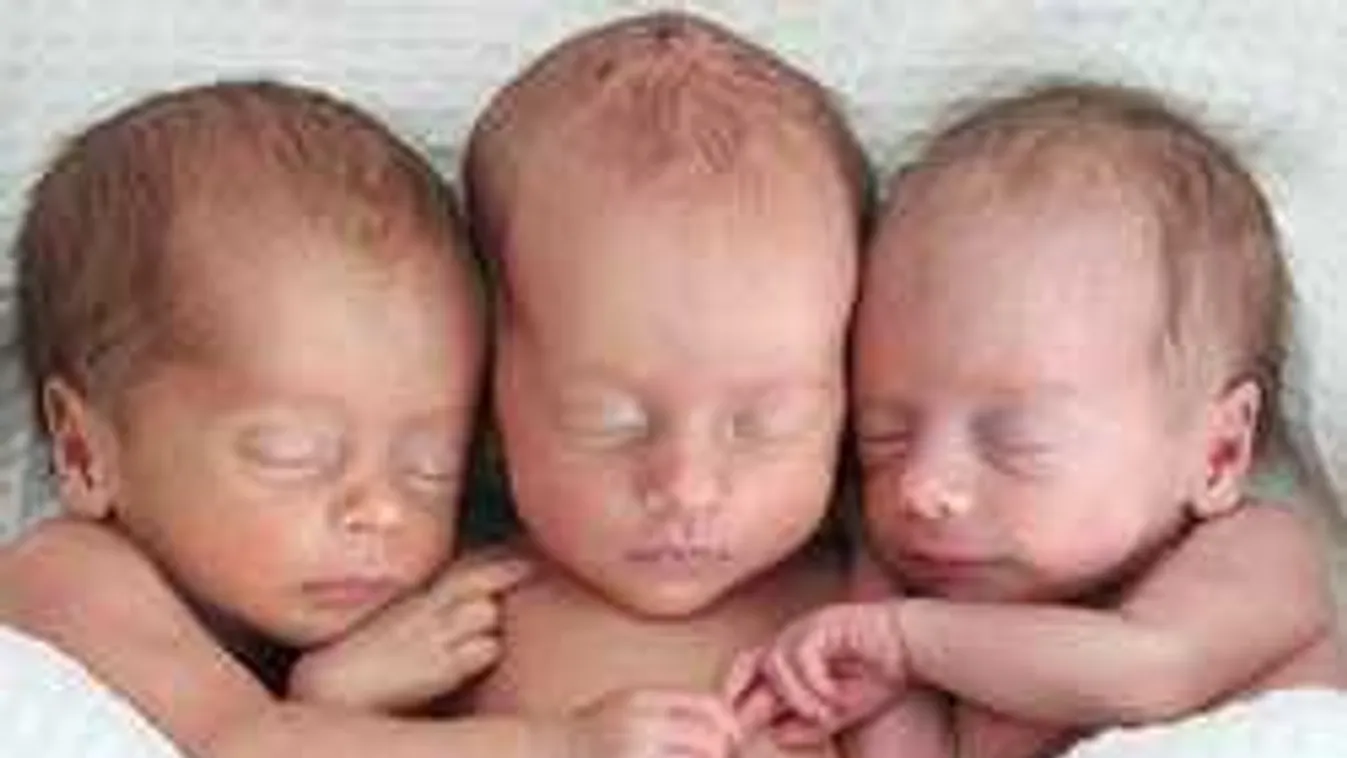 Ezért is különleges, hogy hármas ikrek születtek Borsodban
