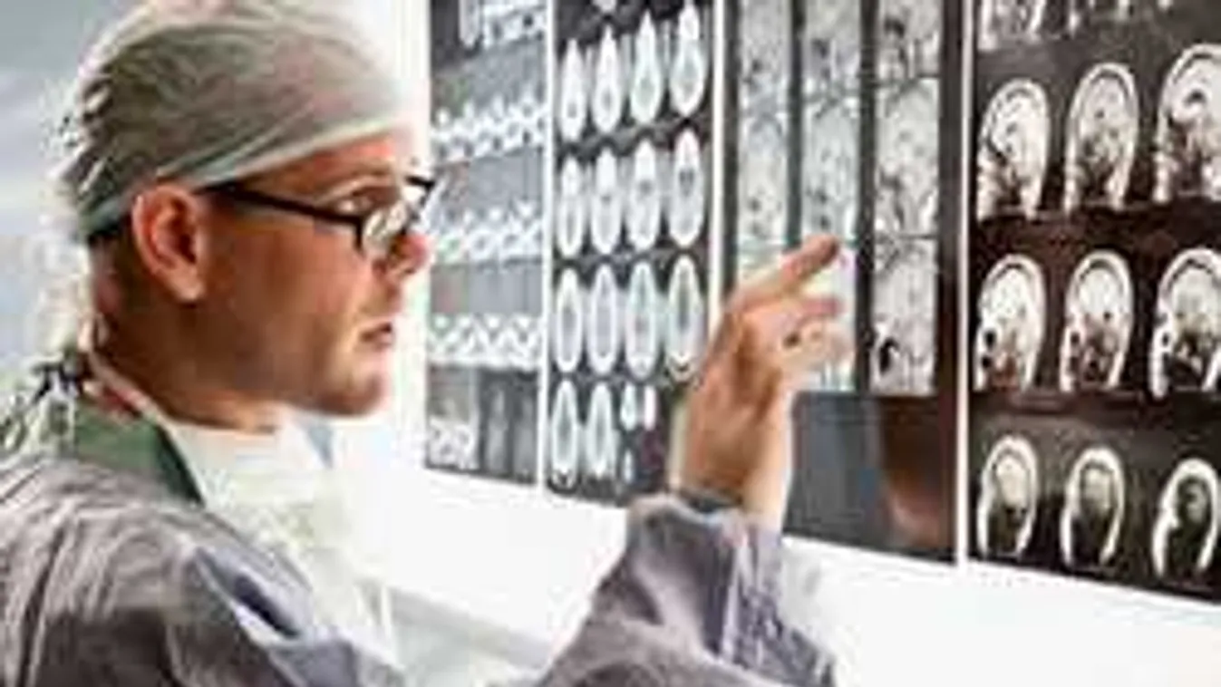 Megrázó bejelentés! Agydaganata van az Édes élet sztárjának!