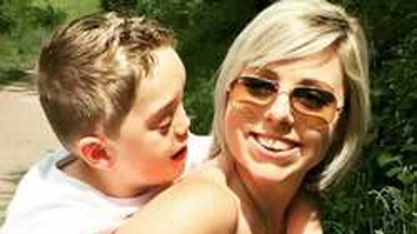 Harc indult a furcsa kórban szenvedő gyerek képeiért