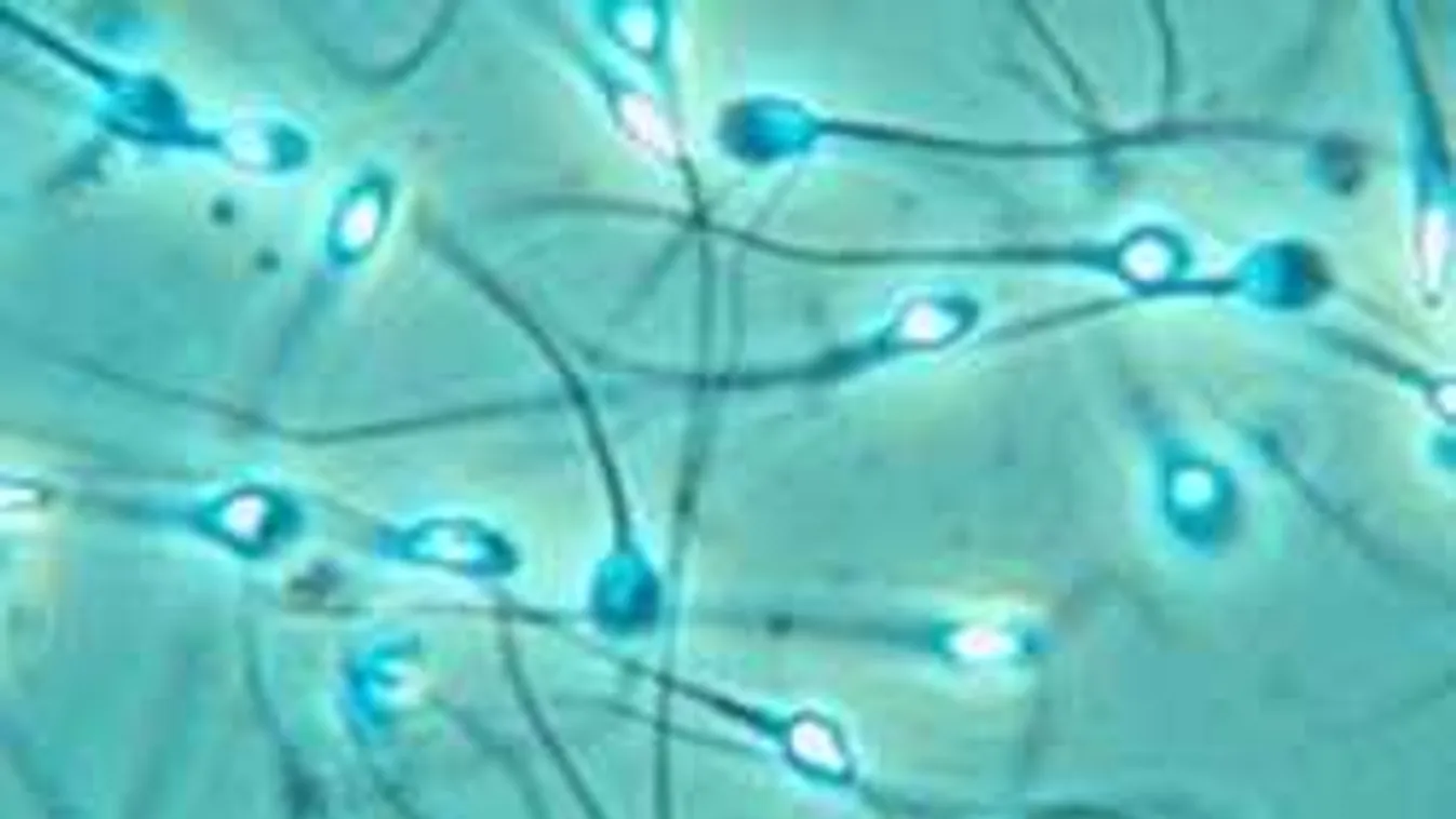 Megdöbbentek a tudósok, amikor kiderült a spermateszt eredménye