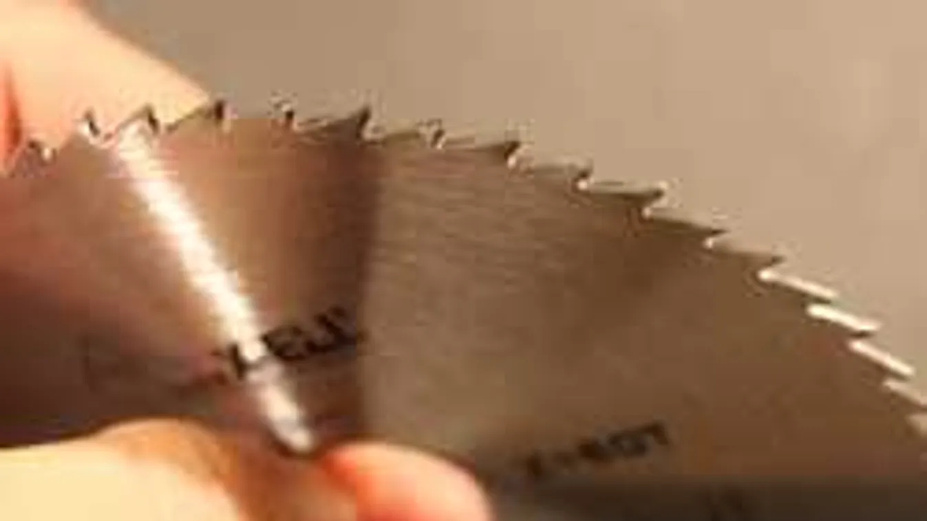 Családja nem hitte el: brutális balesetet szenvedett a nyugdíjas