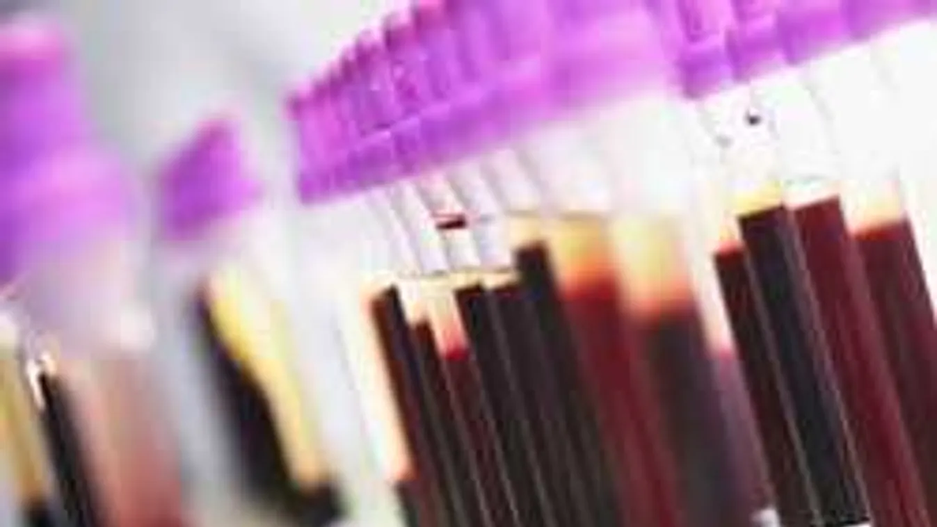 8 meglepő dolog, amit egy egyszerű vérvizsgálat elárulhat rólad