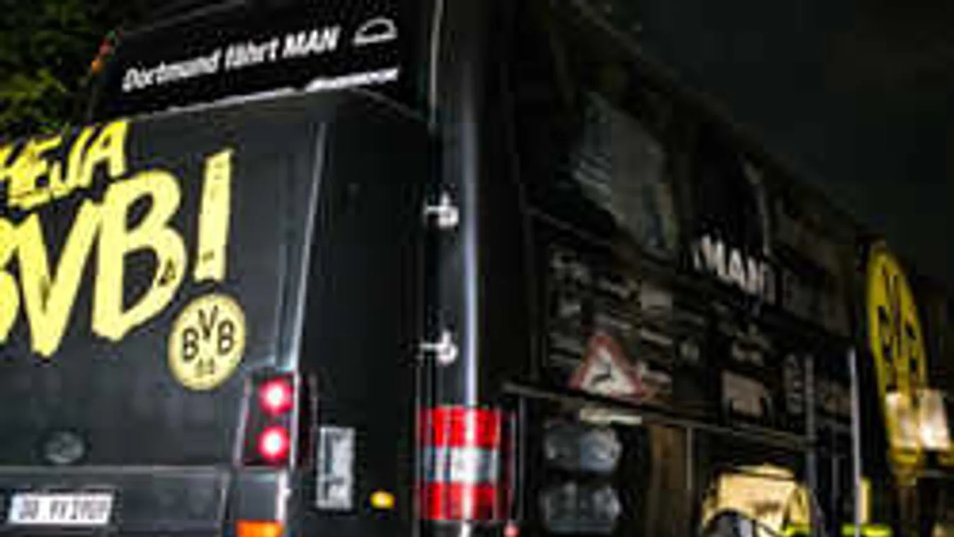 Pokolgépes merénylet, szenvednek a traumától a világsztárok