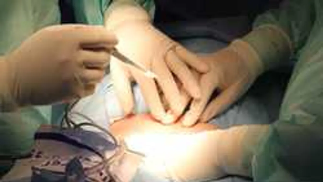 Egyiptom utcáin sokszor szerv nélküli emberek holtteste hever