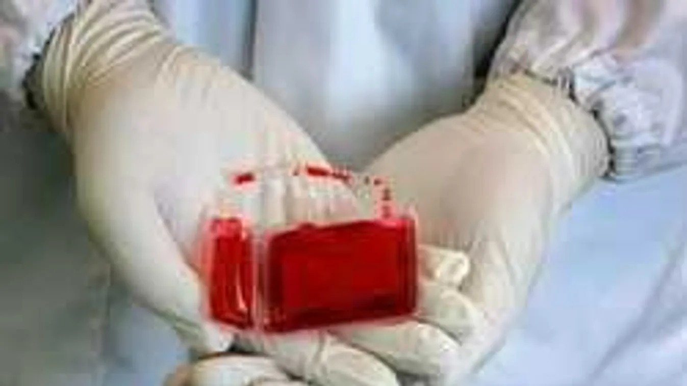 Szabó Zsófi őssejtügye: Kiakadtak a nők, miért nem jár mindenkinek?