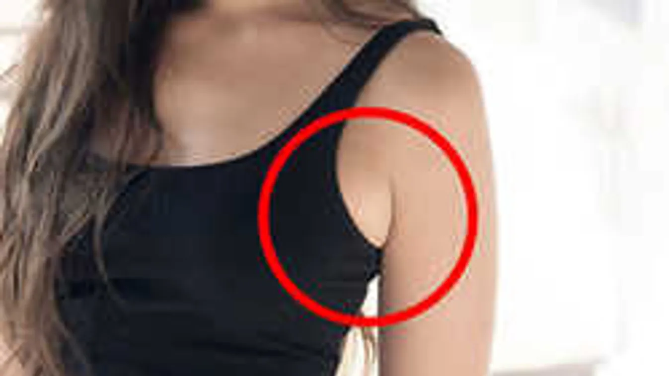 Rettegnek a hónaljpuncitól a nők, szerencsére van megoldás!