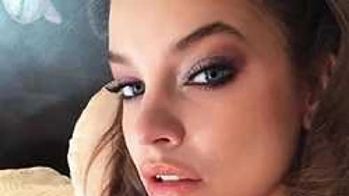 Mi történt? Palvin Barbara csúnyán megsérült - Fotó