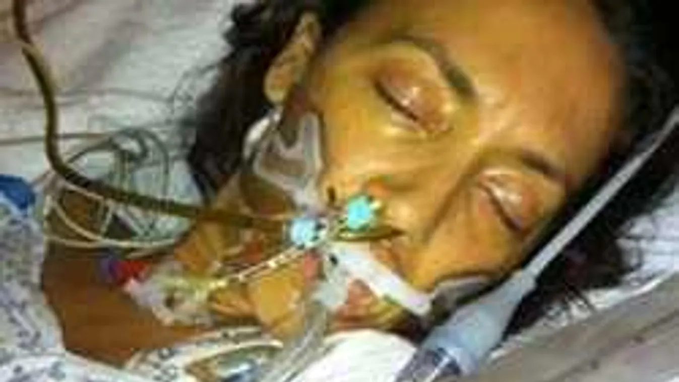 Előbb 20, majd 10 percre halt meg a nő, utána 5 hétre kómába esett