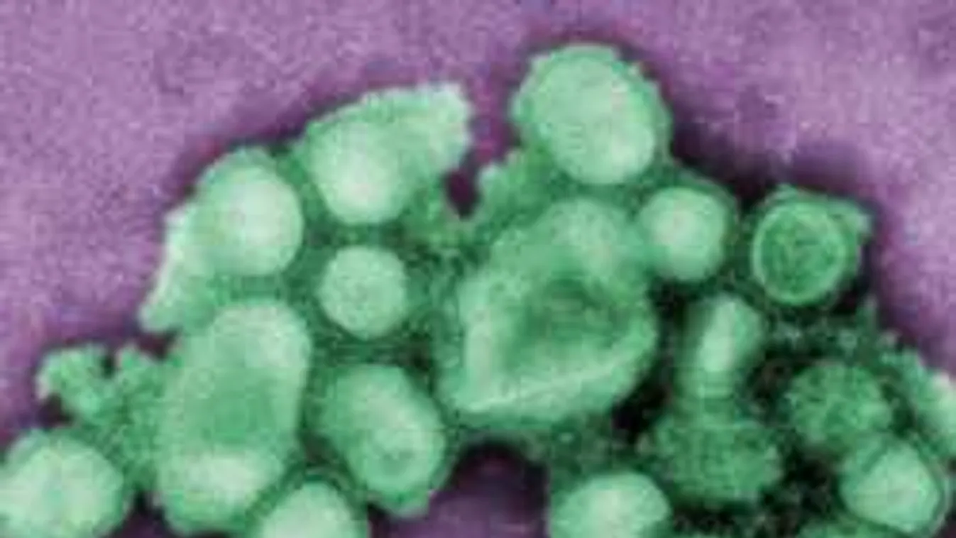 Megjelent Magyarországon a sertésinfluenza, emberről emberre terjed