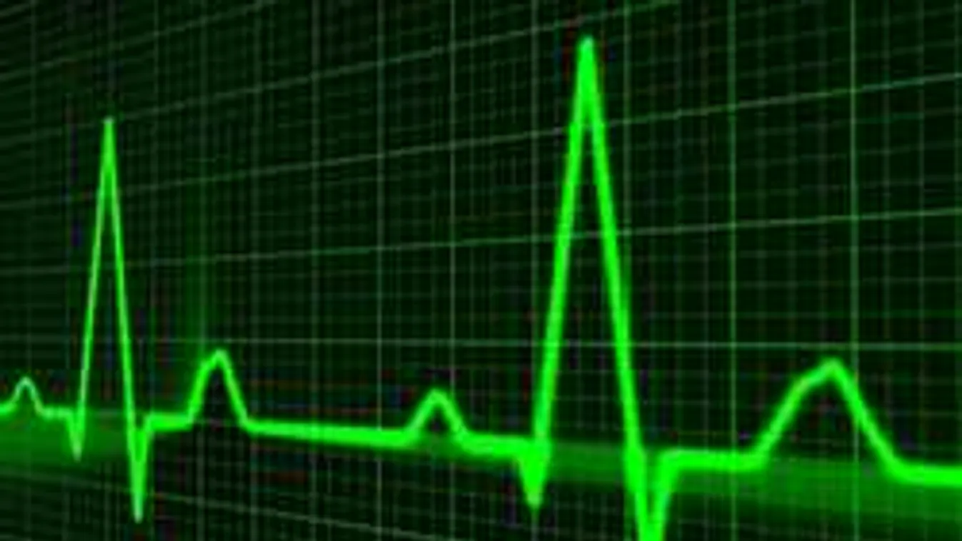 Igazoltatás közben ájult el Zalában egy férfi, a rendőr előtt halt meg