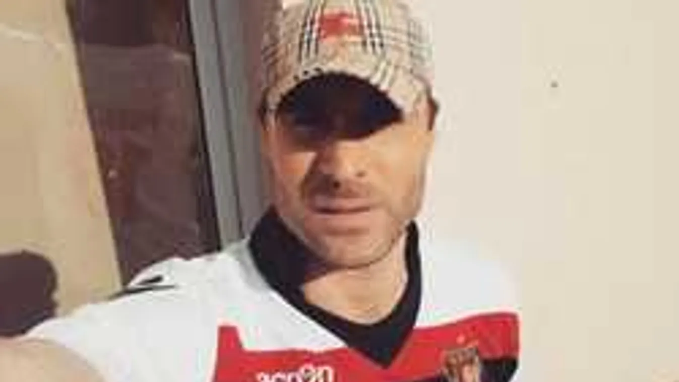 Durva fotó, csúnyán megsérült a TV2 sztárja