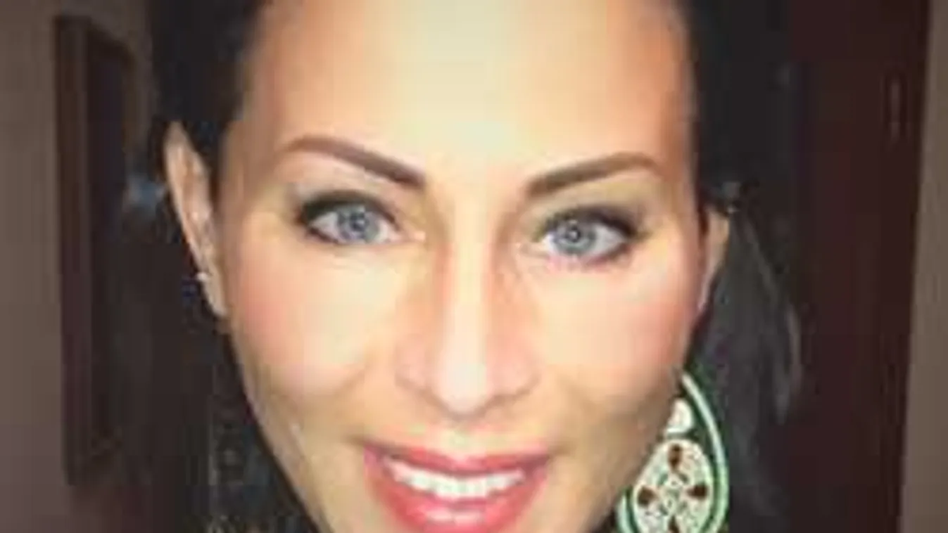 Rá sem ismertünk: Mi történt Tornóczky Anita arcával - fotó