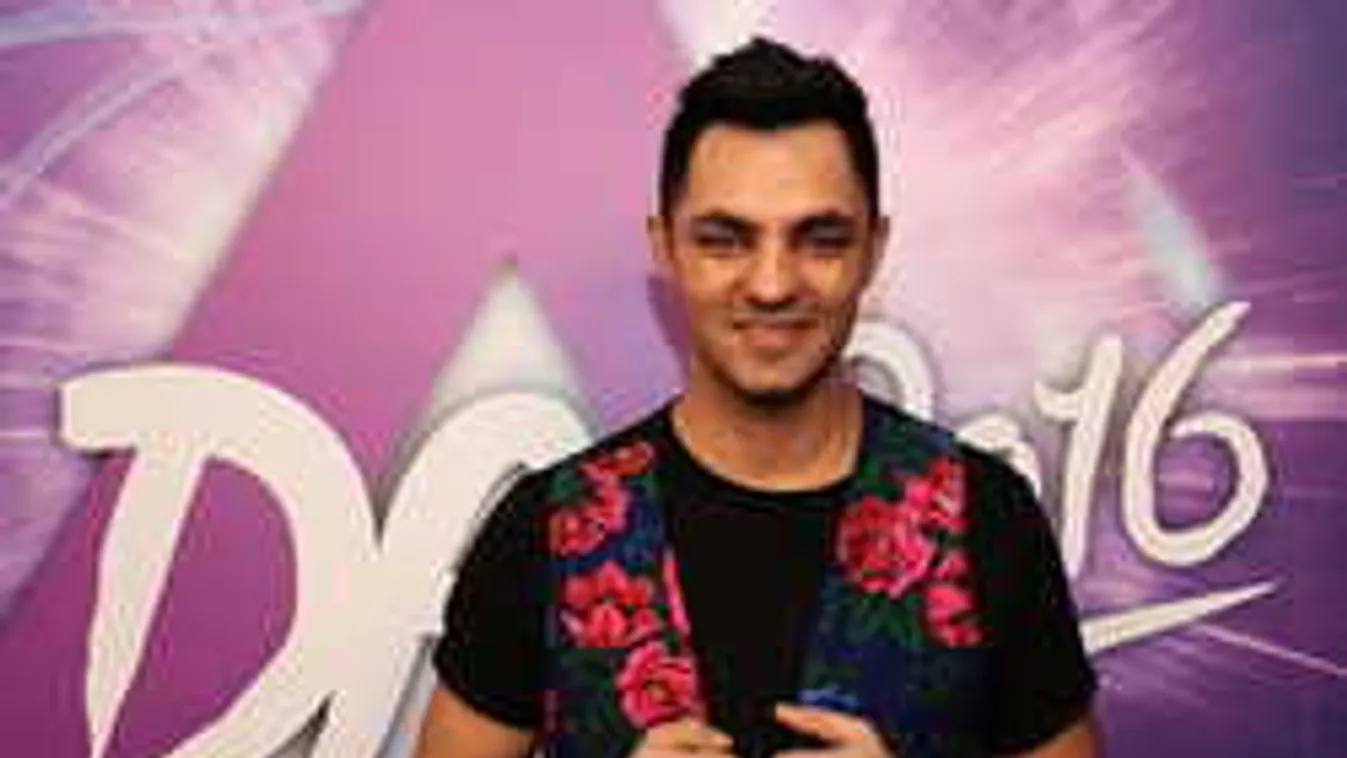 Nem hiszed el mi történt a magyar énekes arcával