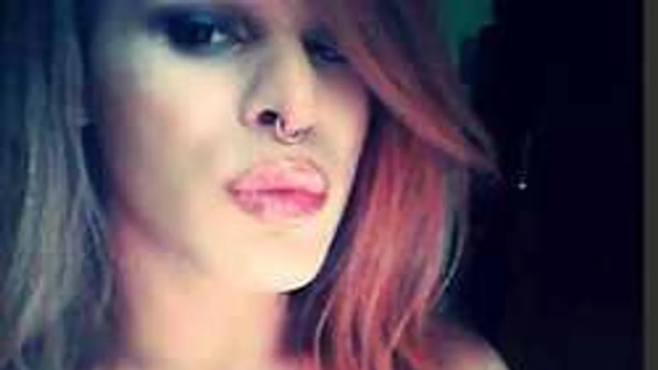 Sokkoló fotó! Durván megverték a magyar énekest!