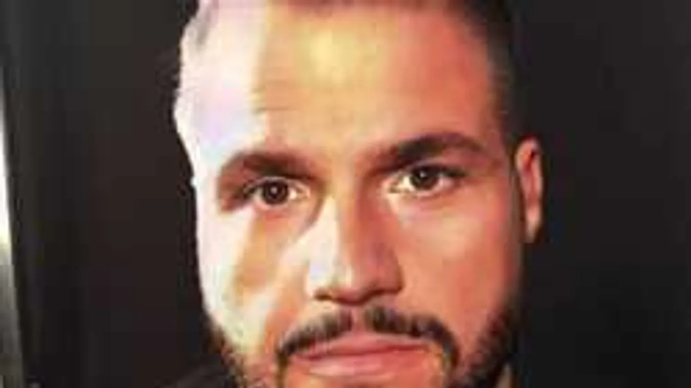 Pokoli fájdalom, hatalmasat reccsent a magyar sztárénekes karja