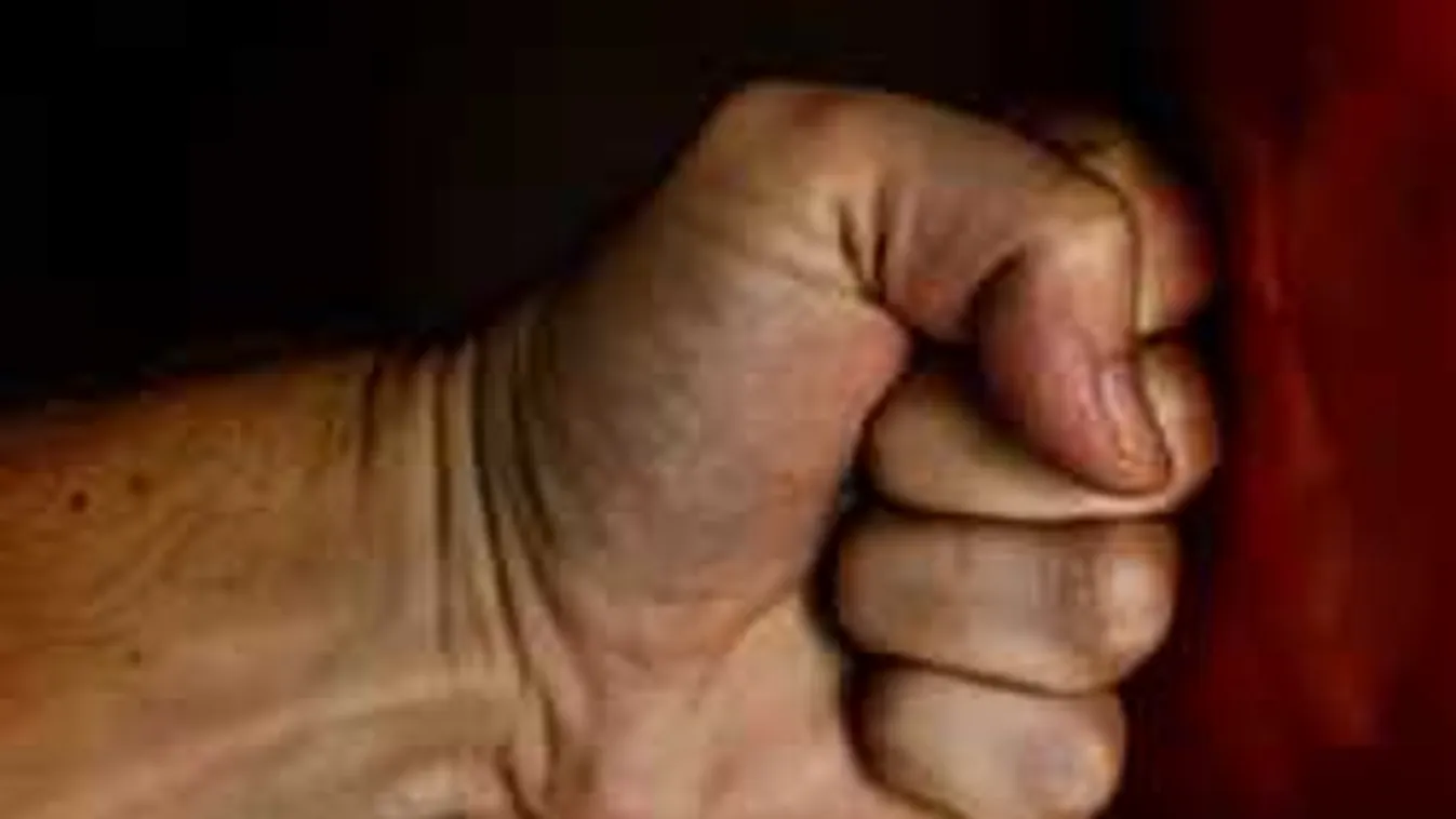 Ököllel verték arcon: Heten támadtak a bolti eladólányra Szabadkán