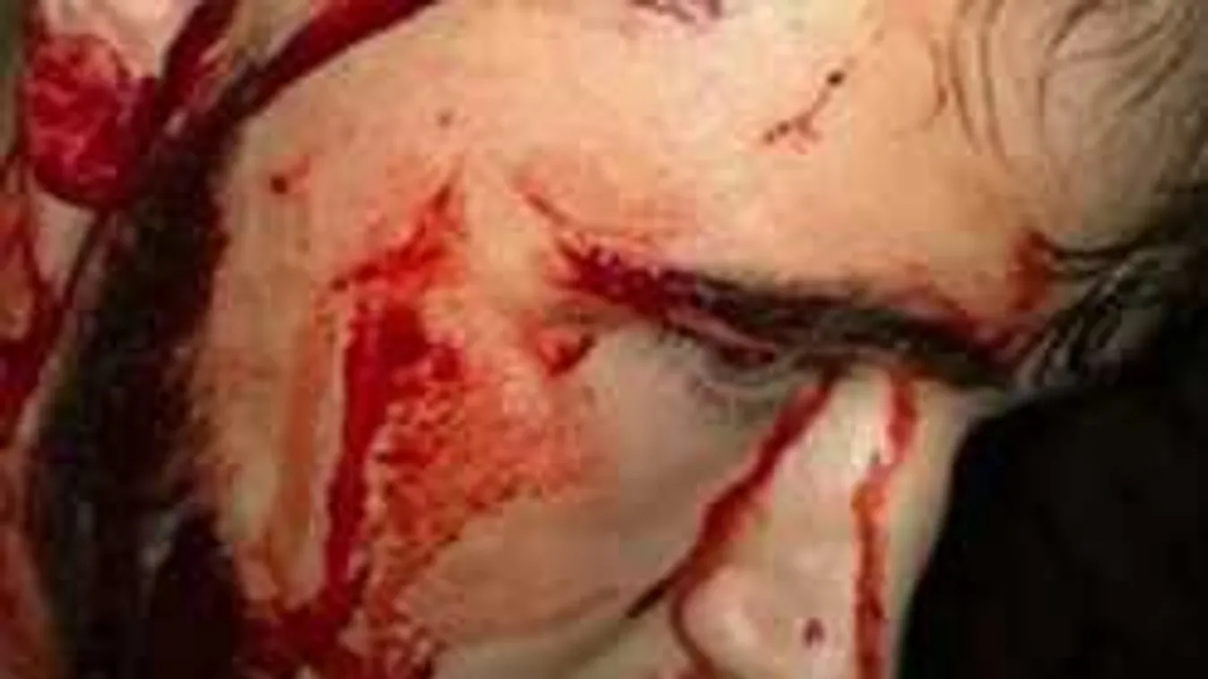 Öt bevándorló csaknem halálra gázolt egy 17 éves angol fiút