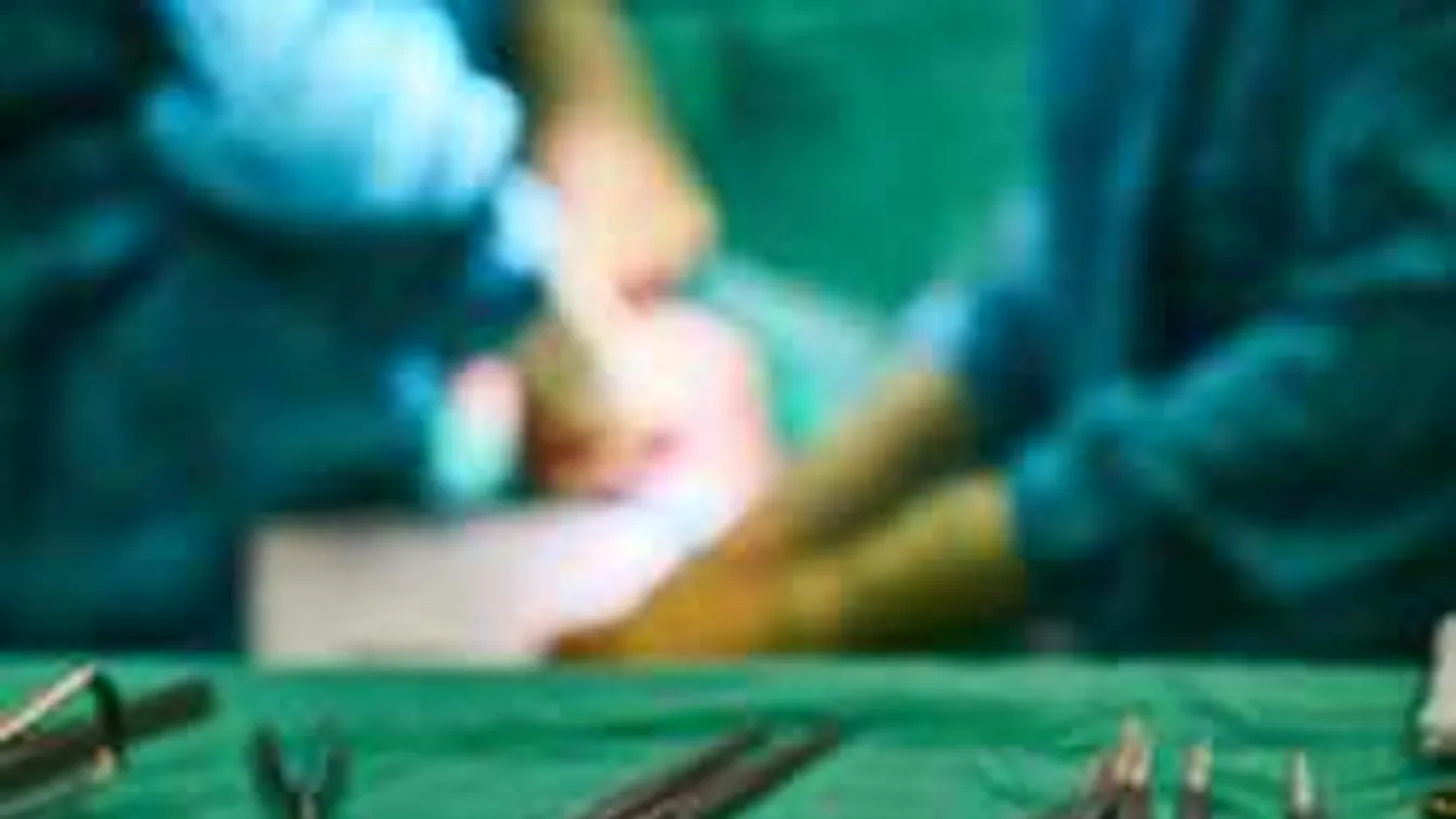 Magyar orvosi bravúr: apró műszerrel váltják ki a lélegeztetőgépet