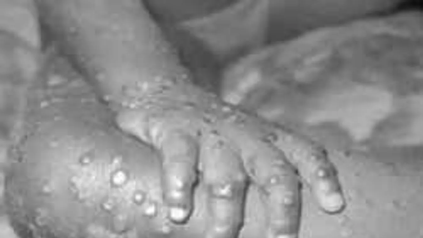 Kiderült, majmoktól származik a nigériai gyilkos vírus