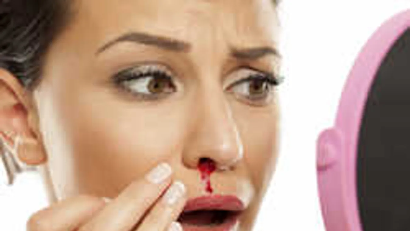 Ekkor veszélyes az orrvérzés, és ezzel a trükkel állíthatod gyorsan el