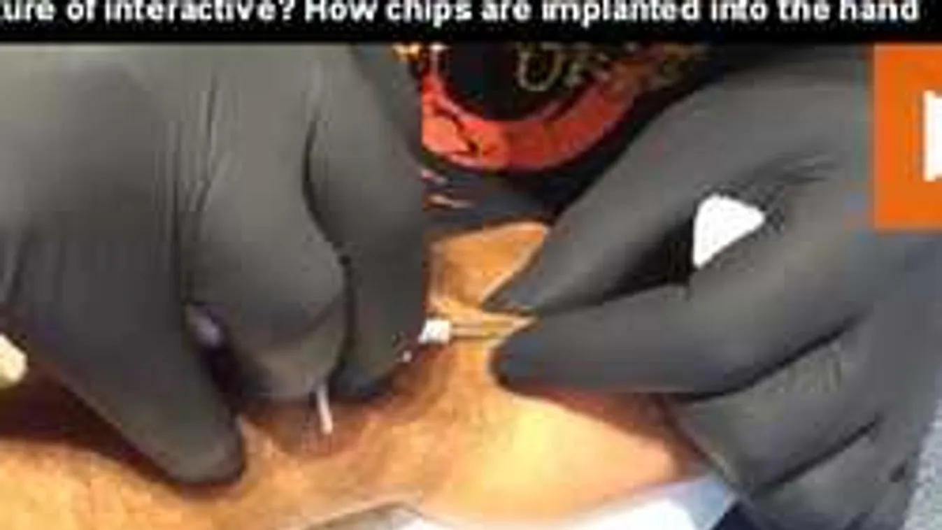 Így lövik beléd a mikrocsipet, már ha hagyod - Videó