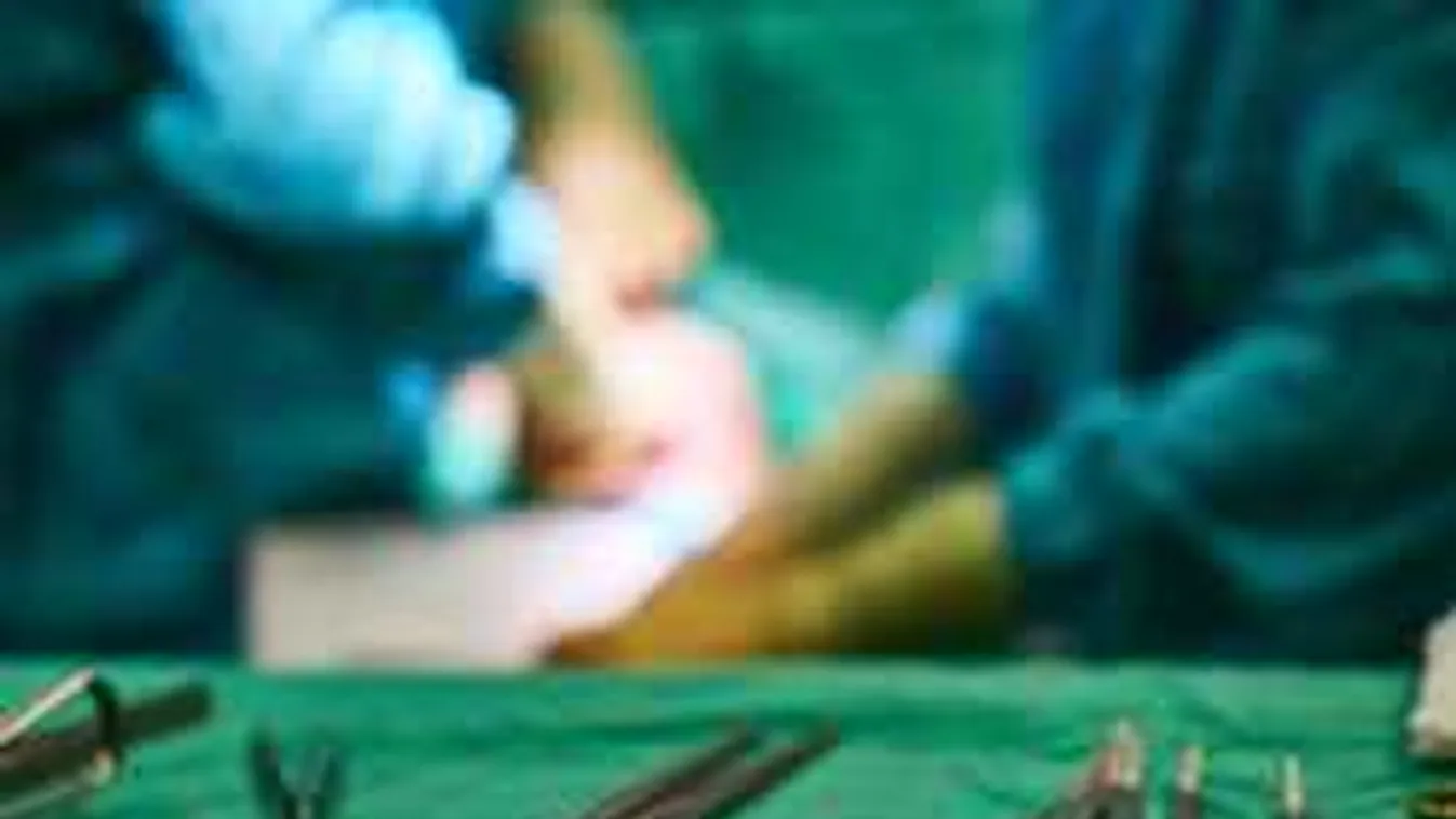 Szörnyű, amit találtak a magyar modellnél: drasztikus lépésre szánta el magát