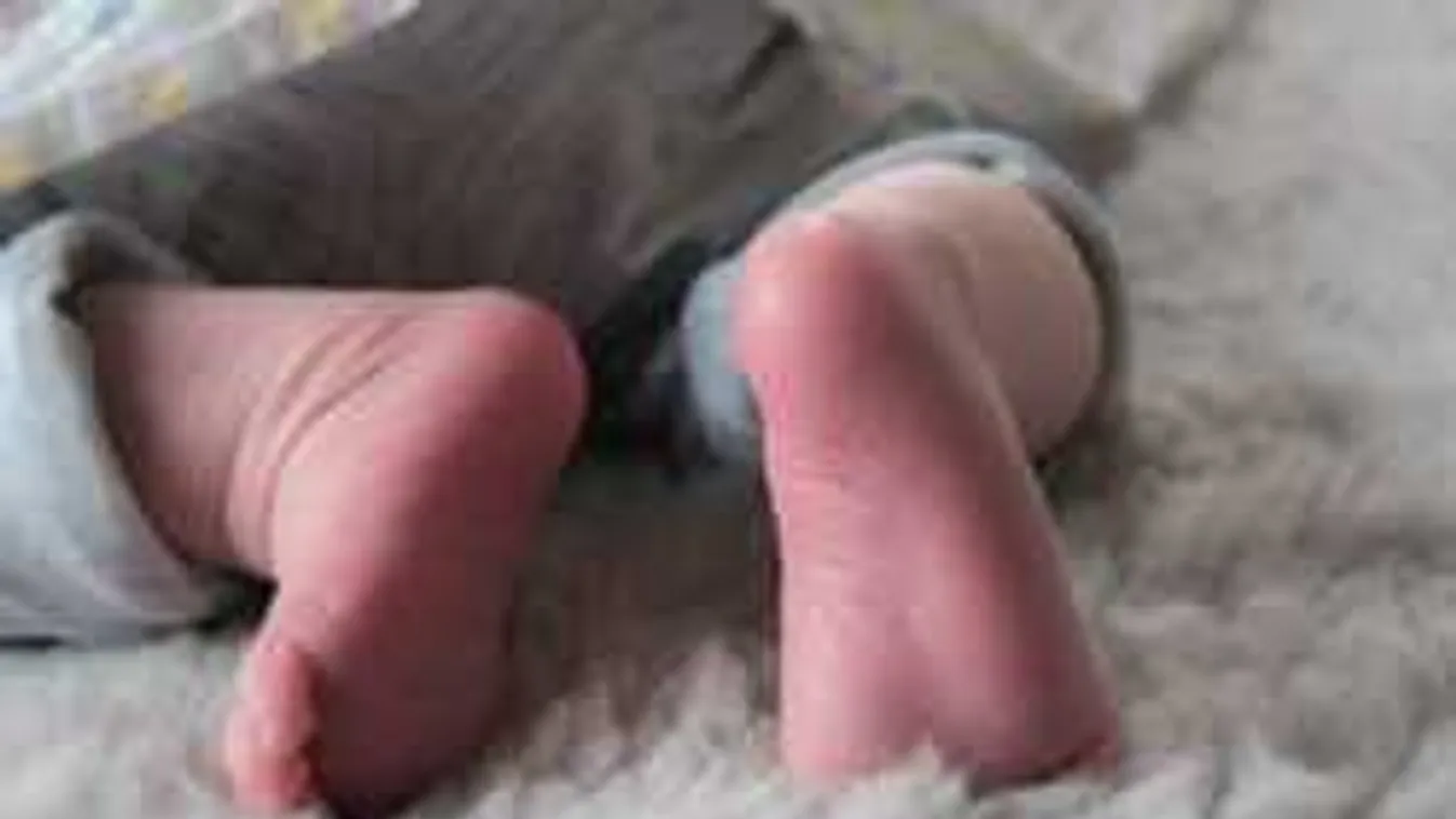 Borzasztó baleset: leejtették a kórházban, betört az újszülött koponyája