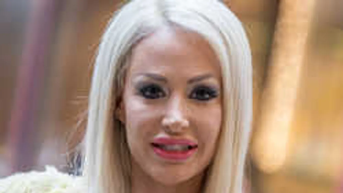 Kelemen Anna reagált az aggódóknak: ezért néz ki így