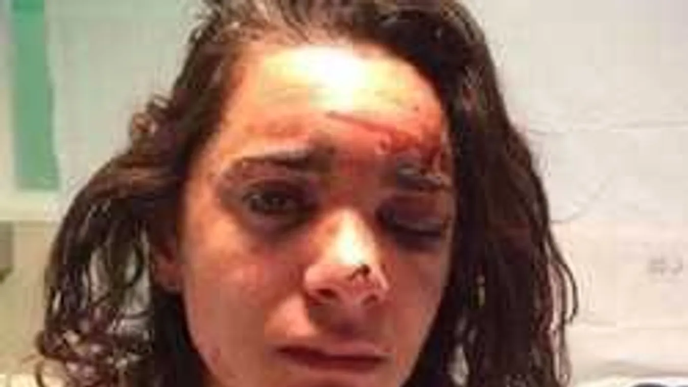 Vérbe fagyva hagyta megerőszakolt áldozatát a főút mellett...