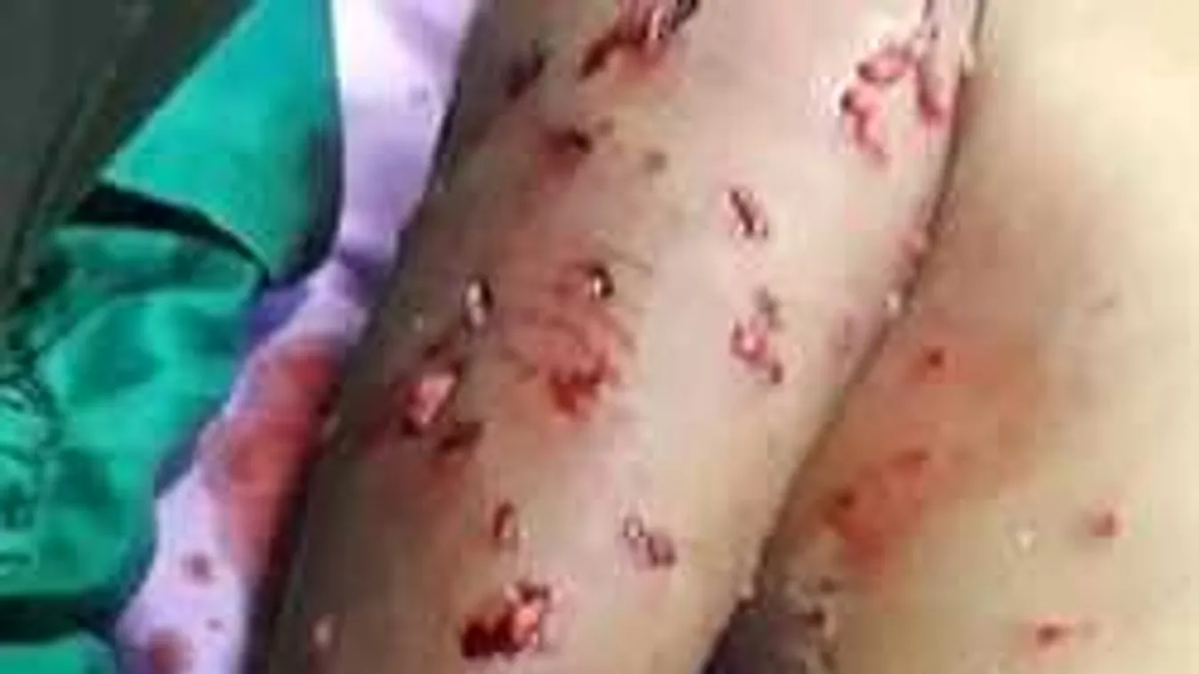 Kutyák marcangoltak meg egy 7 éves kisfiút a magyar turisták nyaralóhelyén