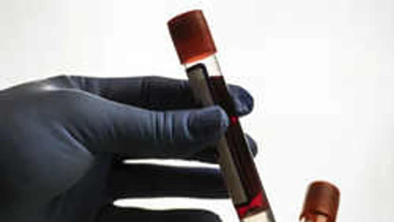 Fantasztikus kutatási eredmények: szegedi orvosok a külföldi szaksajtóban