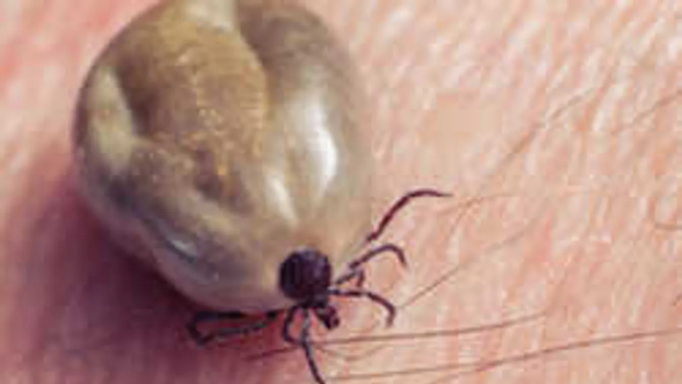 Felejts el mindent, amit a kullancsról hallottál, így kell kiszedni