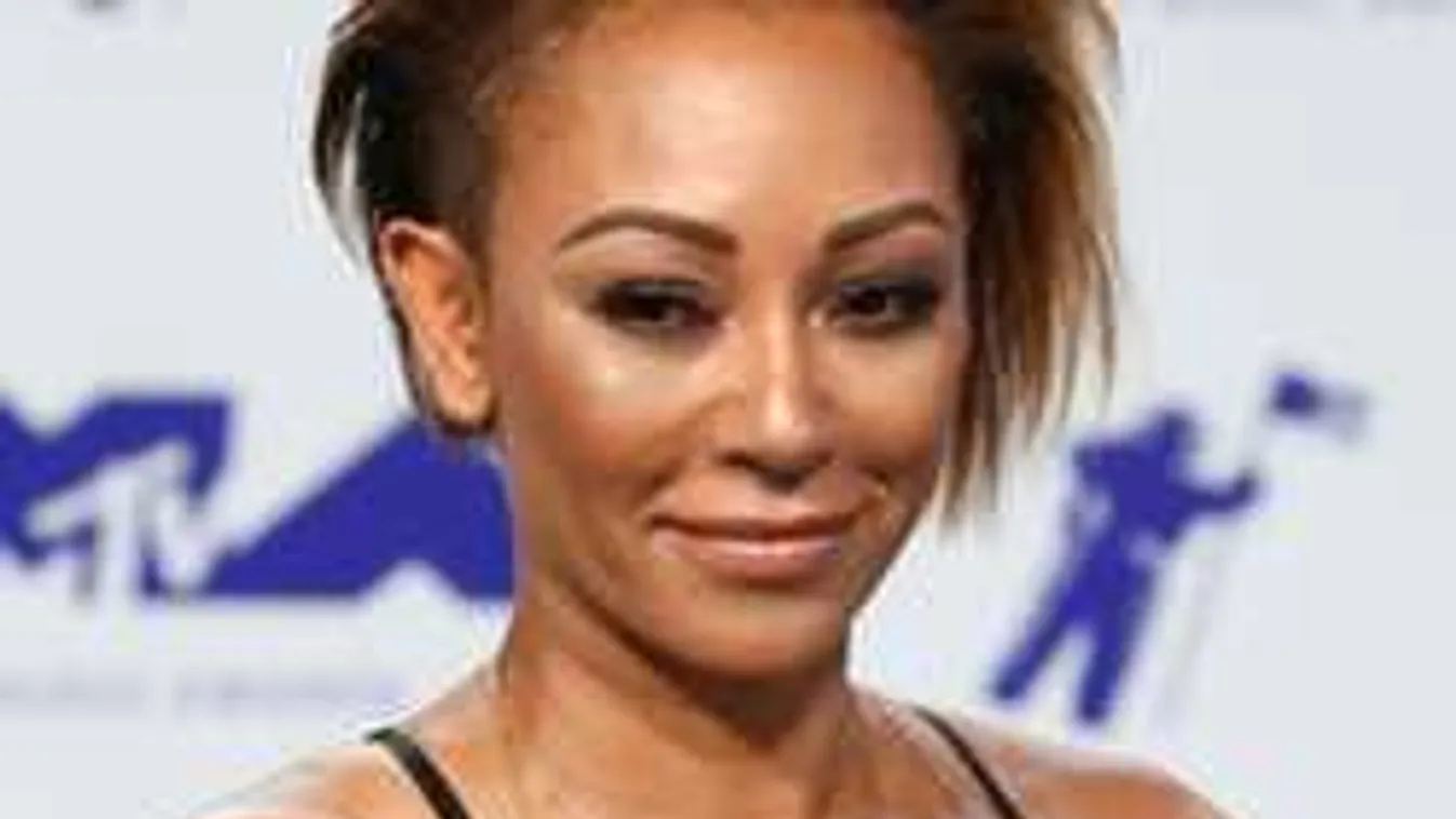 Borzalmas, ami a sztármamival történt, elvesztette látását