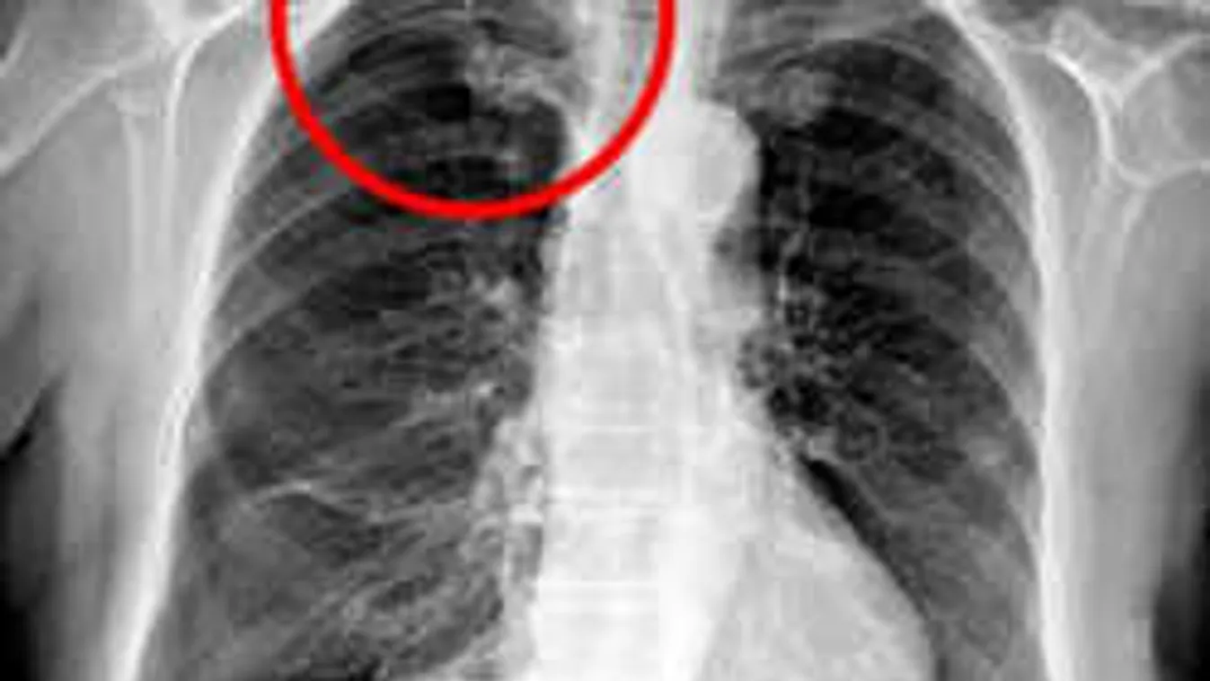 Akupunktúrás kezelést kapott, horror, ami utána történt a beteggel