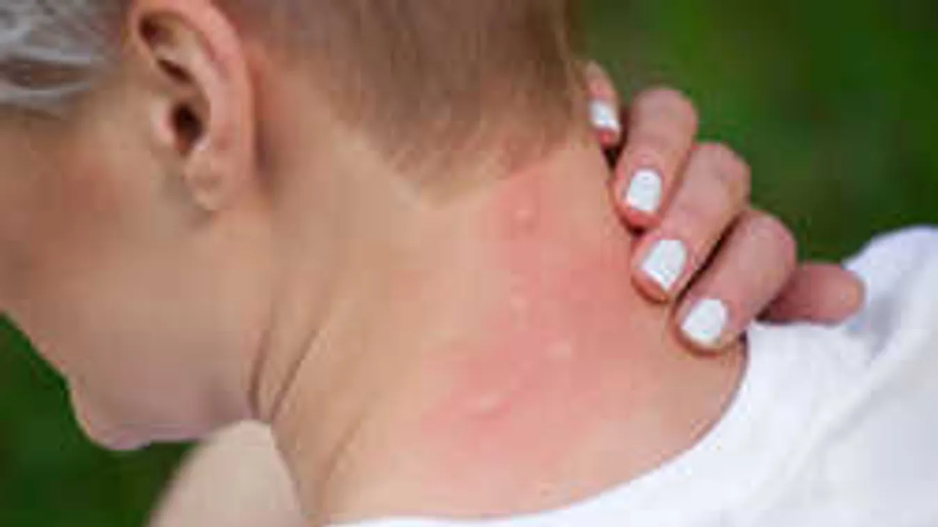 Õrület, mire használják a nyári melegben a banánhéjat a nők