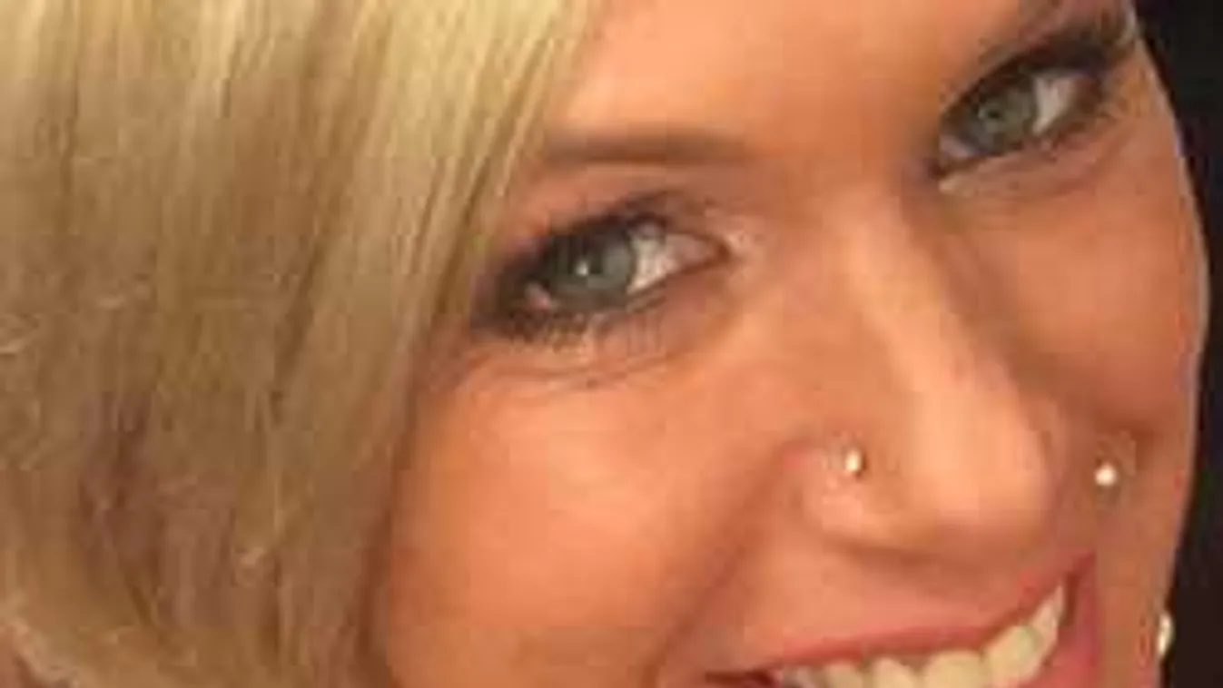 Megszenved a szépségért: fájdalmas műtéten esett át a magyar sztár