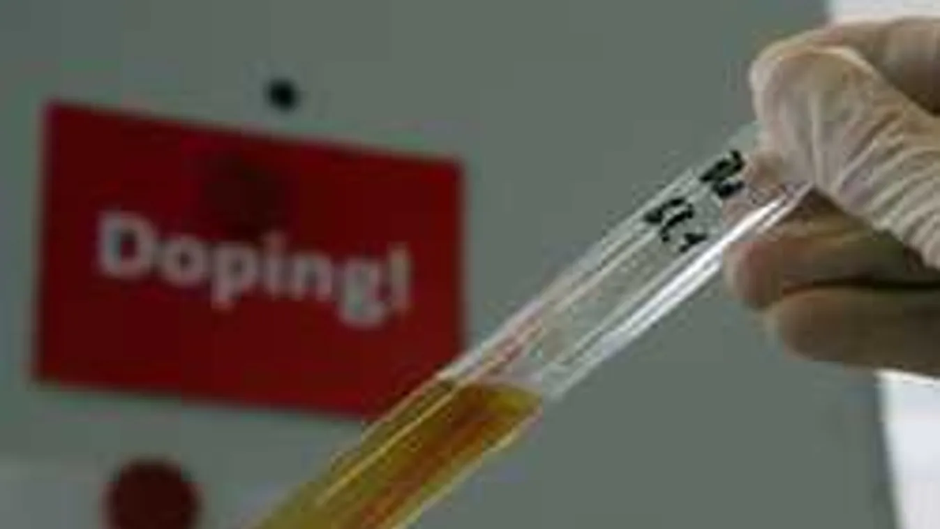 Dagad a pisibotrány, durván lebukott a perverz sportoló