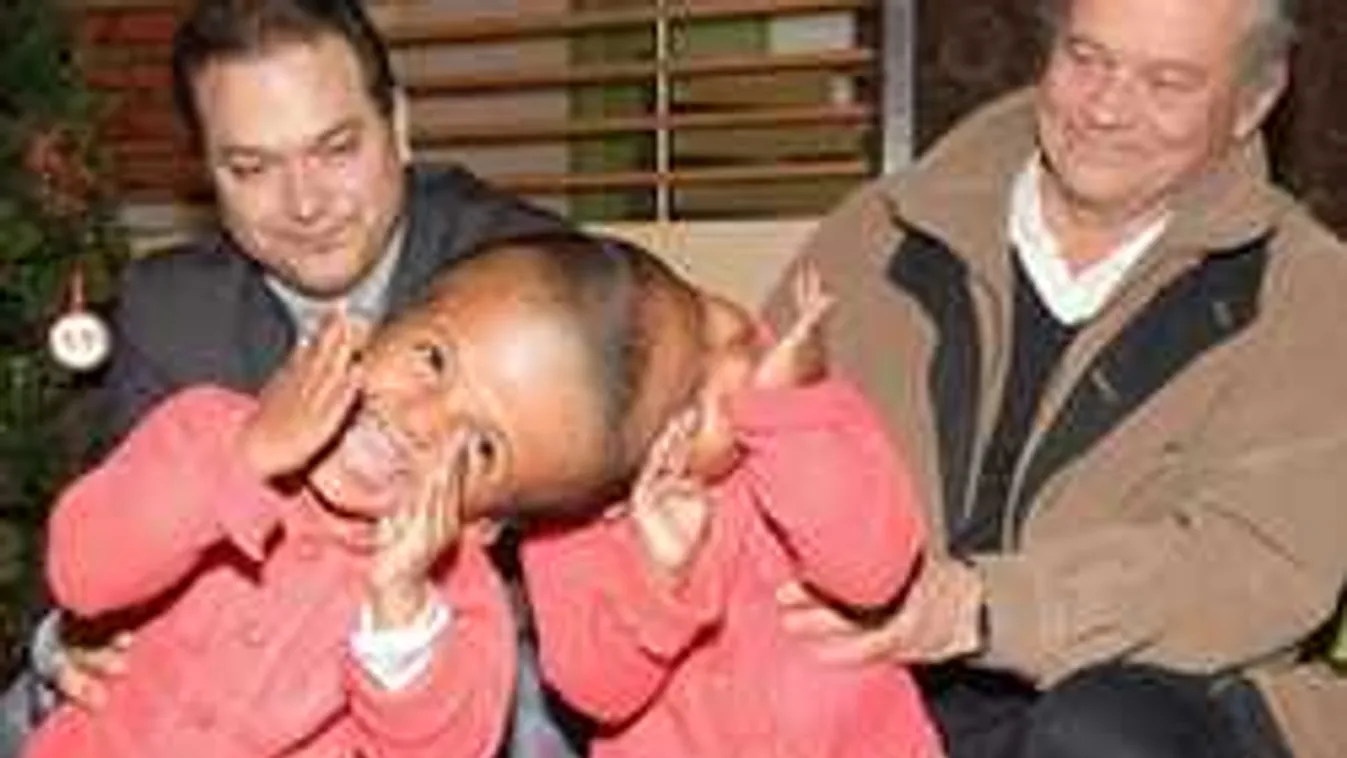 Elkezdődött a sziámi ikrek műtétje, magyarok tízezrei imádkoznak értük